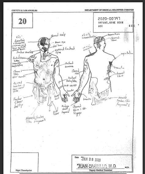 kobe bryant body sketch|A top LA County coroner described in graphic testimony what。